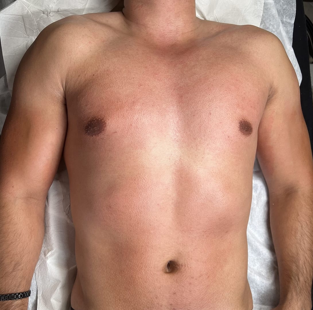 Torse après