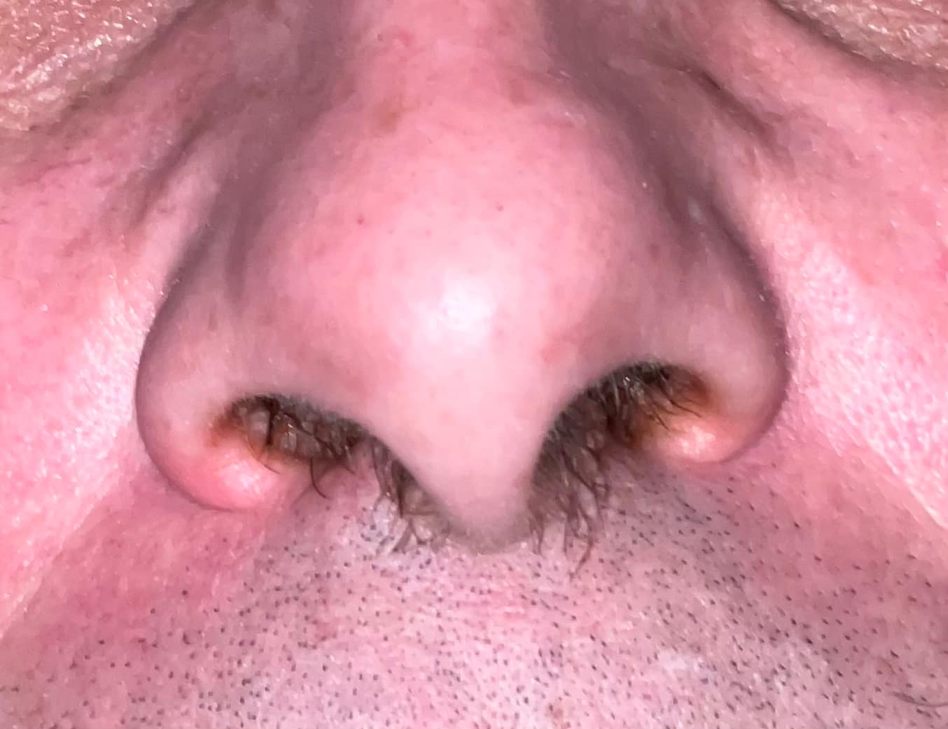nez avant