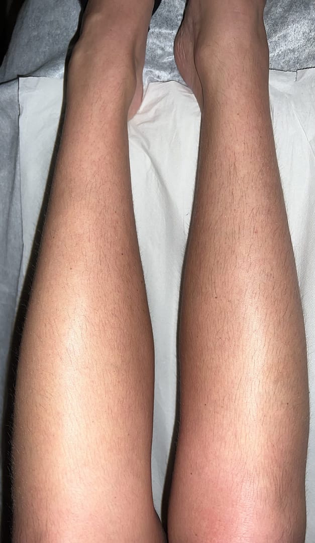 jambes avant