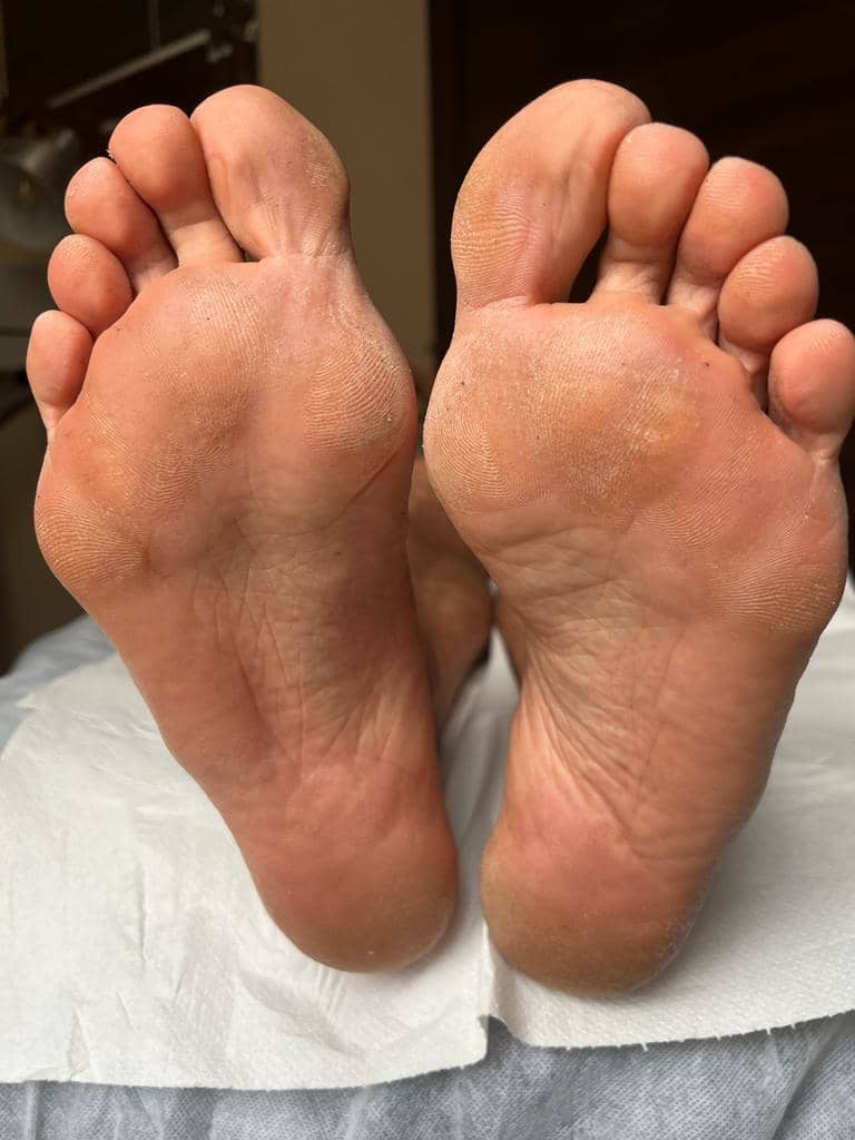 Photo pieds avant