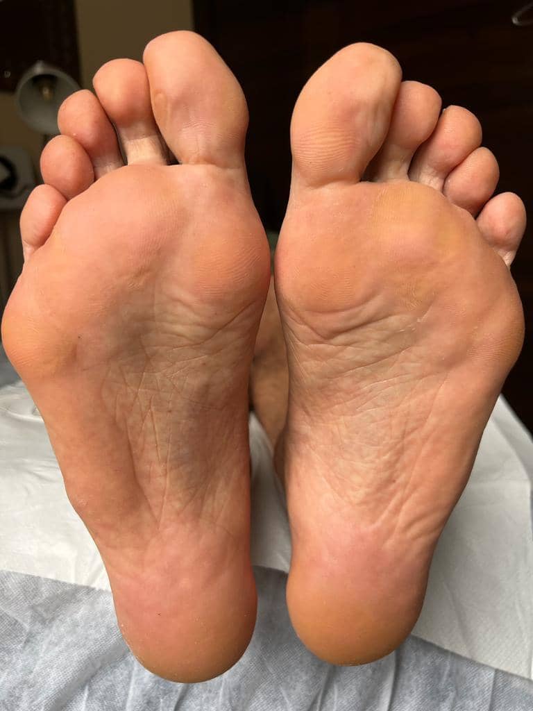 Photo pieds après