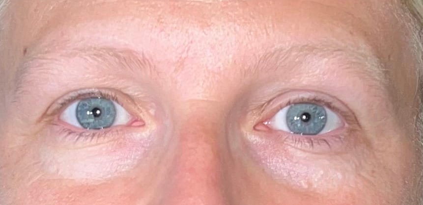 soins des yeux avant