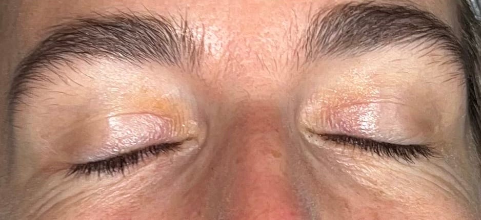 sourcils avant