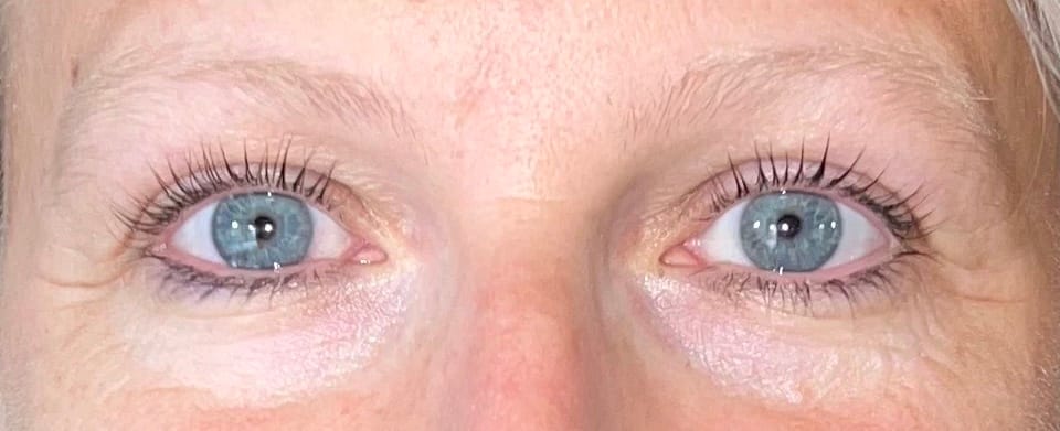 soins des yeux après